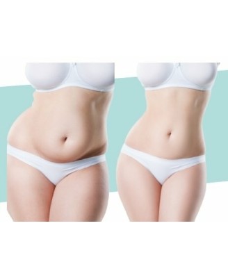 Cryothérapie - 3 séances