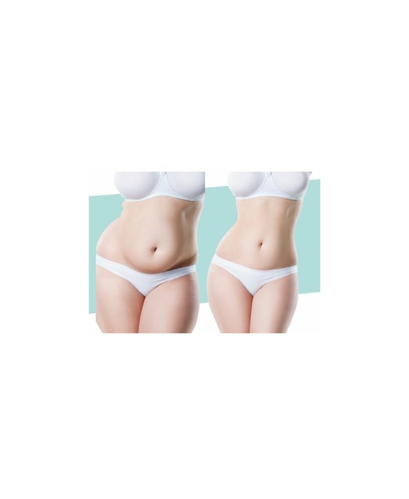 Cryothérapie - 3 séances