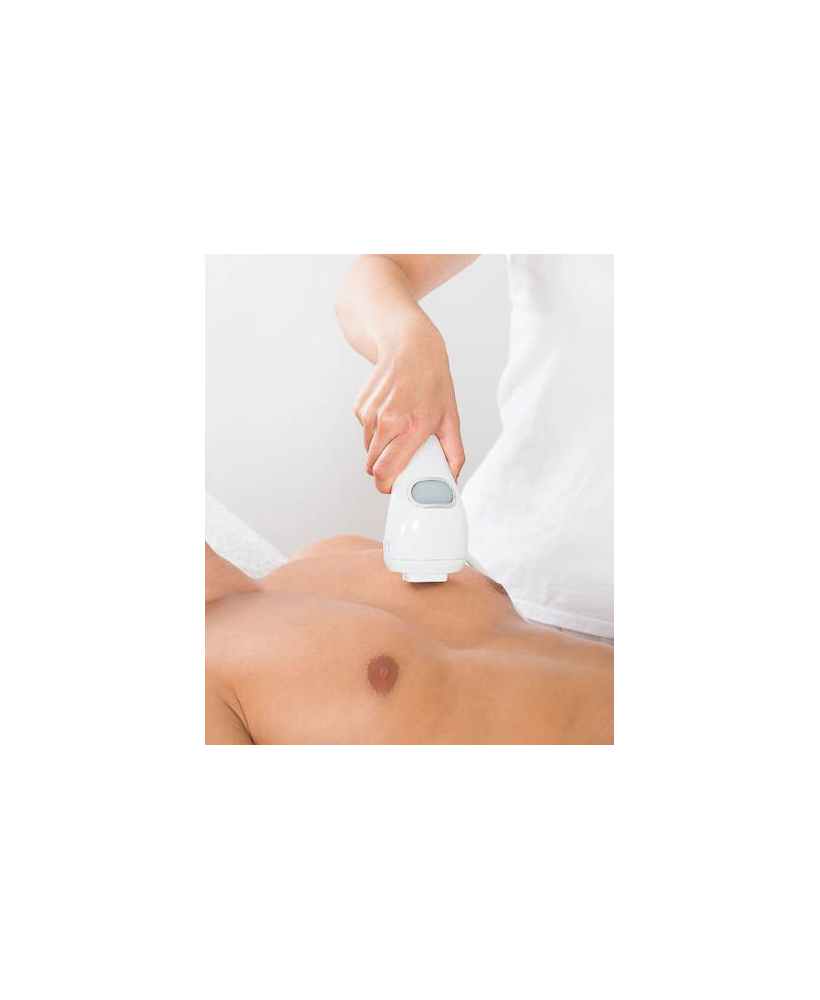 PhotoDépilation cuisses - épilation définitive