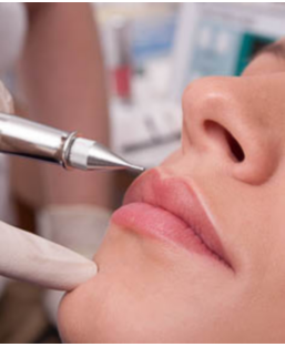 Maquillage permanent Lèvres FULL LIPS