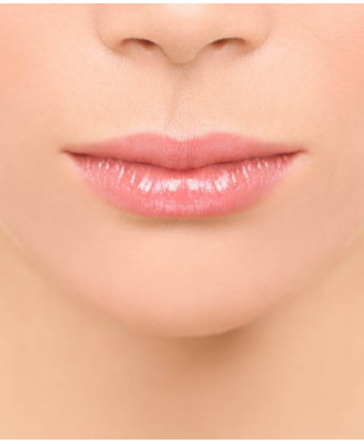 PhotoDépilation Menton - épilation définitive