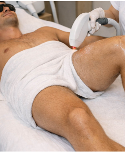 PhotoDépilation cuisses - épilation définitive