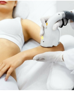 PhotoDépilation bras 1 à 8 séance, épilation définitive