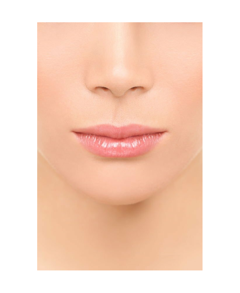 PhotoDépilation Menton - épilation définitive